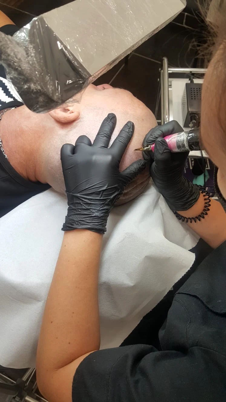 Operatrice O&K Beauty Studio esegue la tricopigmentazione sul cliente